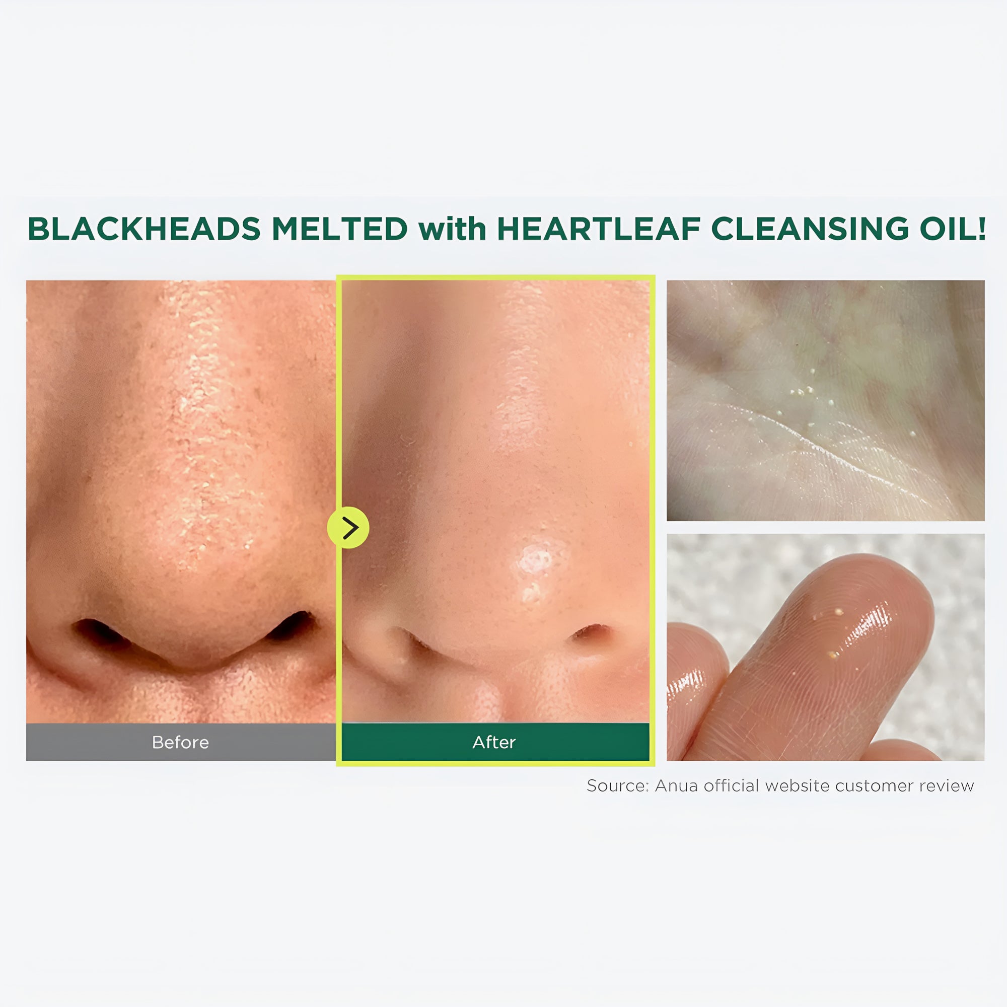 ANUA HEARTLEAF PORE CLEANSING OIL